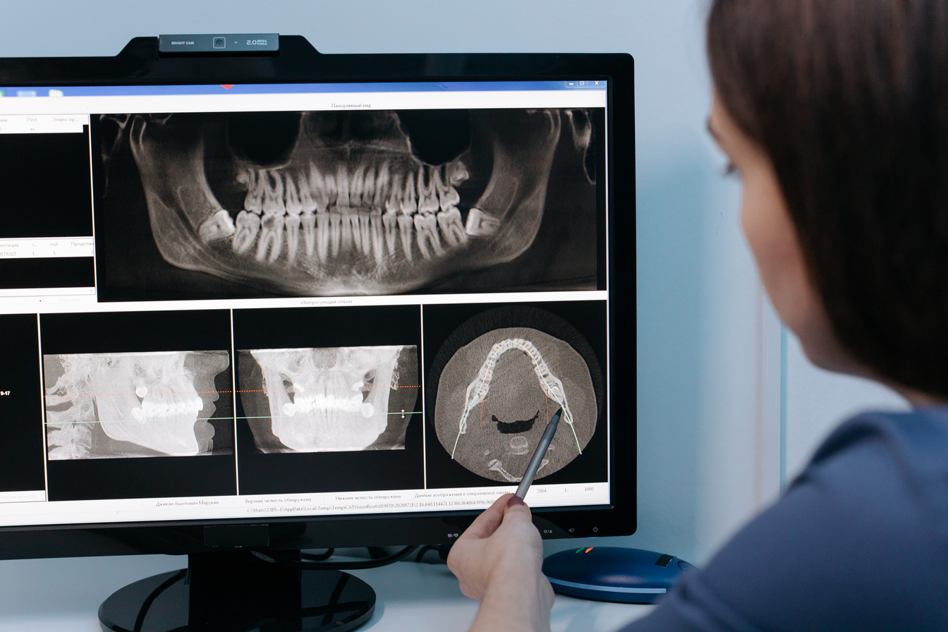 A Dentist Explaining Dental Results